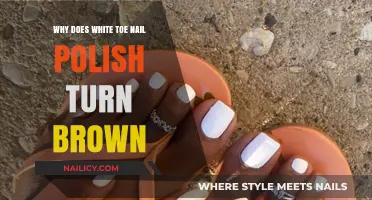 Why White Toenail Polish Turns Brown: Causes and Prevention Tips