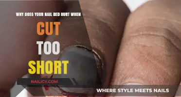 How Short Nails Cause Painful Nail Beds