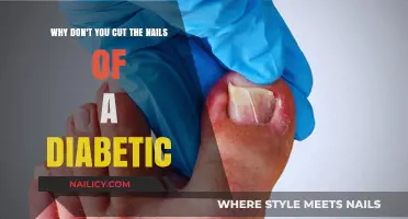 Diabetics and Nail Care: A Delicate Balance