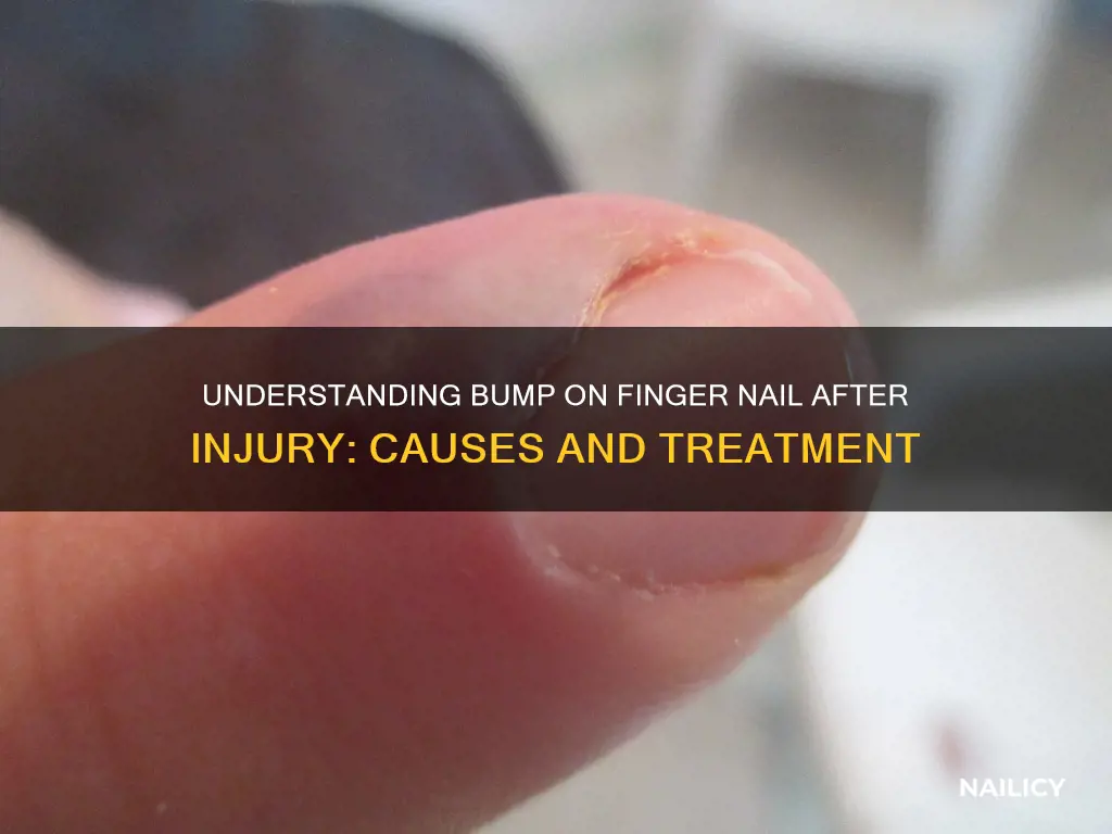 why finger nail has a bump after injury