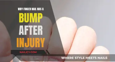 Healing Nails: Bumps After Injury, Why?