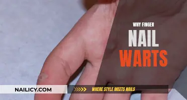 Unveiling the Mystery: Why Finger Nail Warts Appear