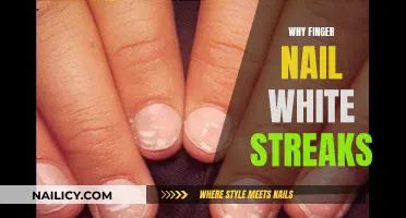 White Streaks on Fingernails: What Do They Mean?