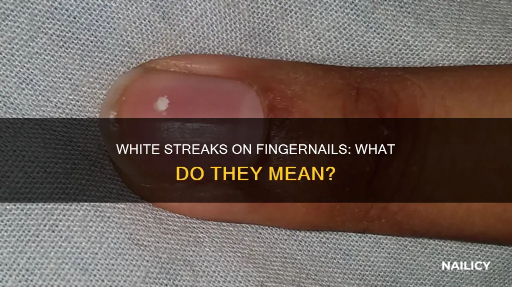 why finger nail white streaks