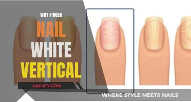 Vertical White Nails: What Your Fingernails Say About Your Health