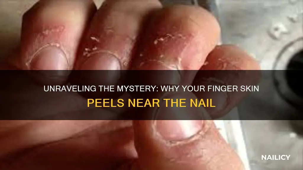 why finger skin peel near nail