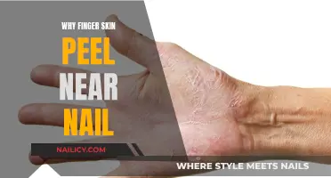 Understanding Skin Peel Near Nails