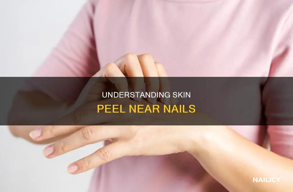 why finger skin peel near nail