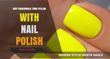 Why Do Fingernails Turn Yellow After Wearing Nail Polish?