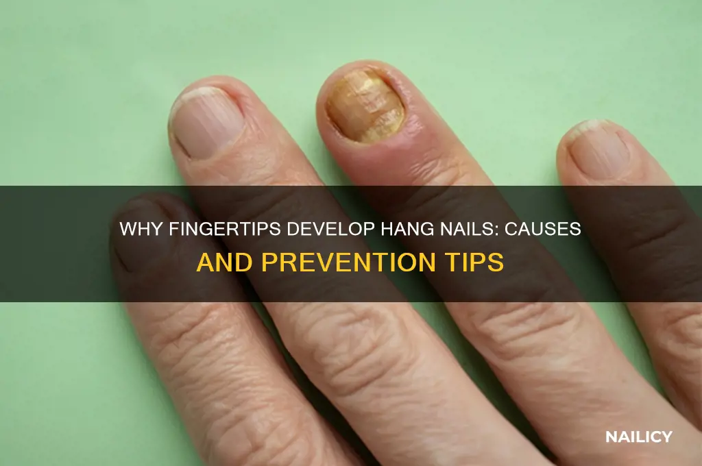 why fingertips have hang nails