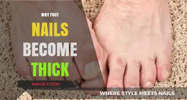 Why Do Toenails Thicken? Causes and Solutions Explained