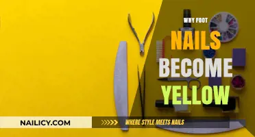 Why Do Toenails Turn Yellow? Causes and Solutions Explained