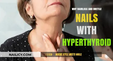 Hyperthyroidism's Impact: Understanding Hair Loss and Brittle Nails Connection