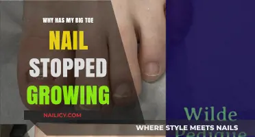 Big Toenail Growth: What's Stopping It?