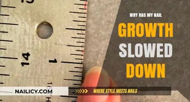 Why Has My Nail Growth Slowed Down? Causes and Solutions