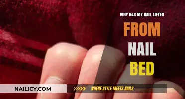 Why Has My Nail Lifted? Causes and Solutions Explained
