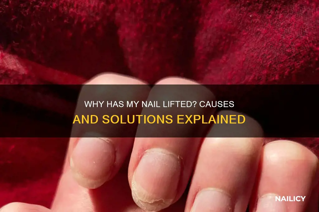 why has my nail lifted from nail bed