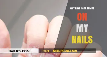 Bumps on Nails: Causes, Concerns, and Effective Solutions Explained