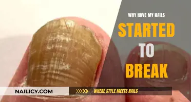 Why Are My Nails Breaking? Causes and Solutions Explained