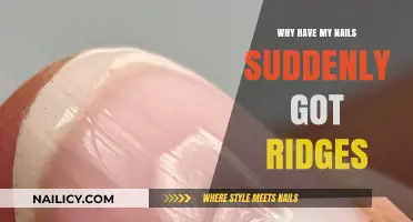 Why Do My Nails Suddenly Have Ridges? Causes and Solutions