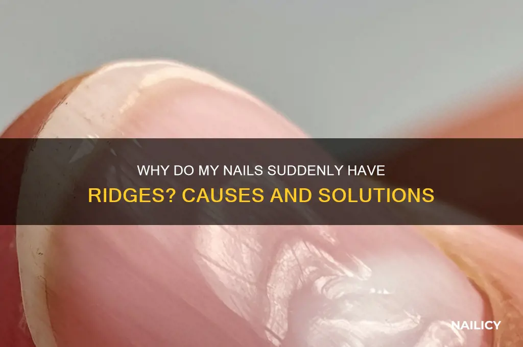 why have my nails suddenly got ridges