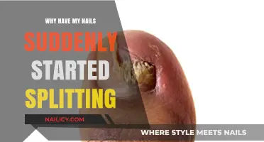 Sudden Nail Splitting: Causes and Solutions for Brittle Nails