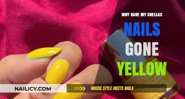 Why Shellac Nails Turn Yellow: Causes and Prevention Tips