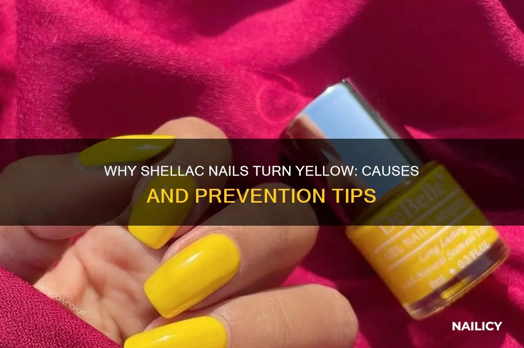 Why Shellac Nails Turn Yellow: Causes And Prevention Tips | Nailicy