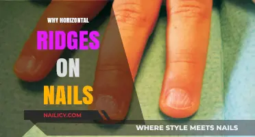 Horizontal Ridges on Nails: Causes, Concerns, and Solutions Explained