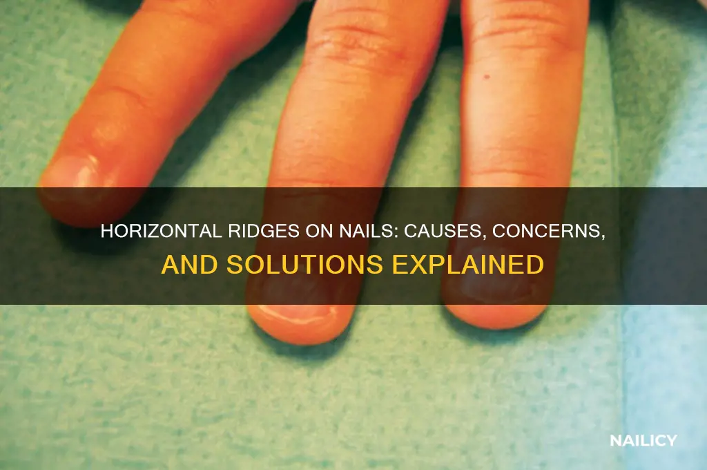 why horizontal ridges on nails