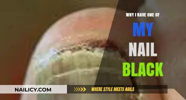 Why One of My Nails Turned Black: Causes and Concerns