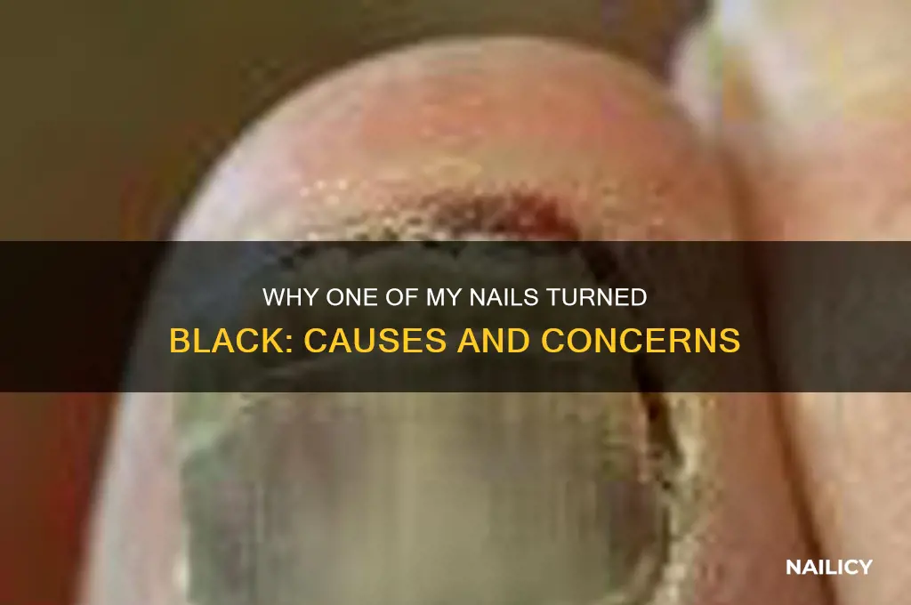 why i have one of my nail black