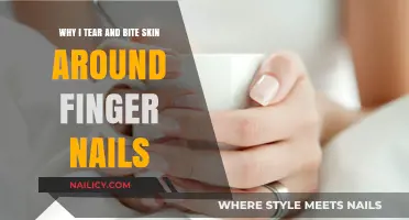 Nail Biting and Skin Tearing: Why the Habit?