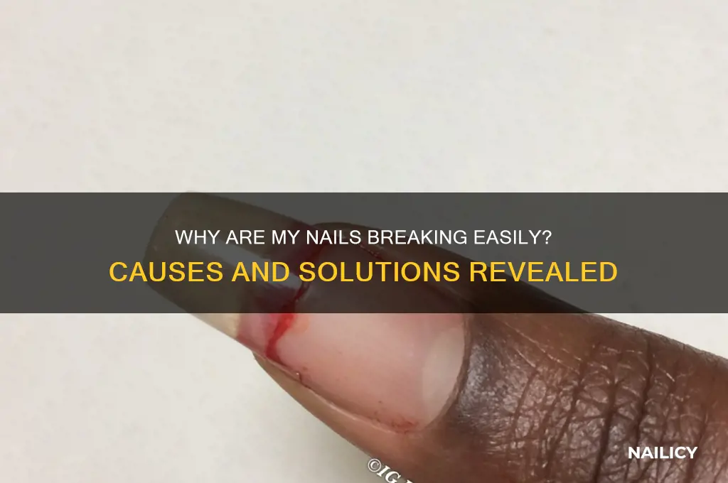 why ia my nail breaking so easily
