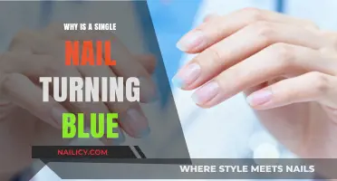 Why Is a Single Nail Turning Blue? Causes and Concerns