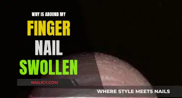 What Does a Swollen Fingernail Mean?