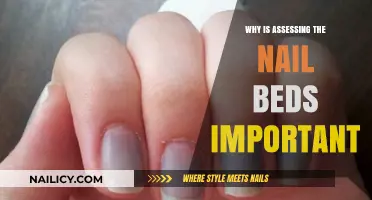 Assessing Nail Beds: Uncovering Vital Health Clues Beneath the Surface