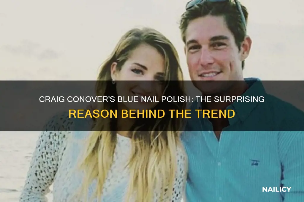 why is craig conover wearing blue nail polish