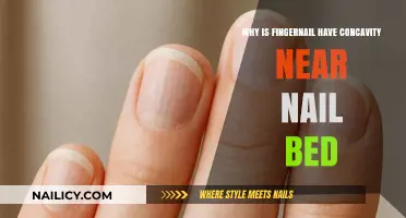 Understanding the Natural Concavity of Fingernails Near the Nail Bed