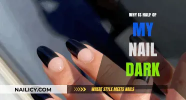 Dark Nail Half: Causes, Concerns, and When to Seek Help