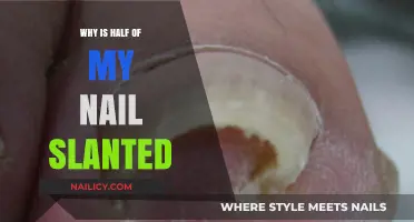 Slanted Nail Mystery: Causes and Solutions for Uneven Nail Growth