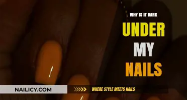 Why Are My Nail Beds Dark? Causes and Solutions Explained