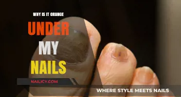 Why Are My Nails Orange? Causes and Solutions Explained