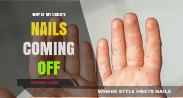 Child's Nails Peeling Off: Causes, Concerns, and Solutions Explained