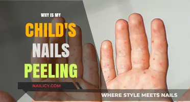 Why Are My Child's Nails Peeling? Causes and Solutions Explained