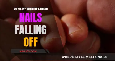 Daughter's Fingernails Falling Off? Here's Why and What to Do