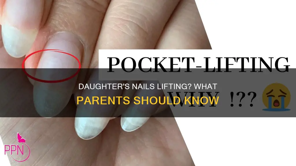 why is my daughters finger nails lifting from nail bed