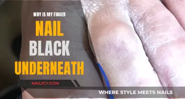 Black Underneath Nail: Understanding the Dark Mystery Beneath