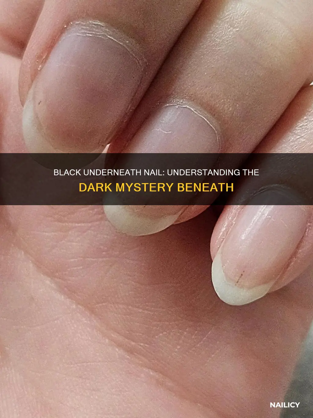 why is my finger nail black underneath