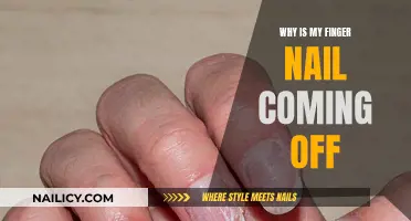 The Mystery of Nails Peeling Off: What's the Cause?